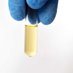 A doctor holding a urine sample for drug testing